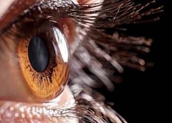 Katarakt Ve Kırma Kusurlarınızda Trifokal Mercekler