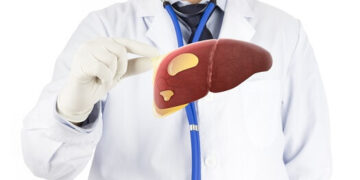 Karaciğer yağlanması