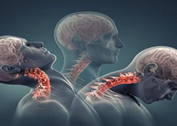 Boyun Düzleşmesine Dikkat