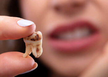 Dişleri Çürüklerden Korumanın Yolları