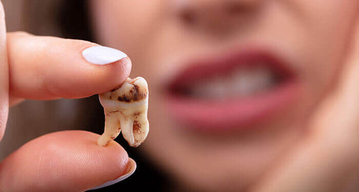 Dişleri Çürüklerden Korumanın Yolları