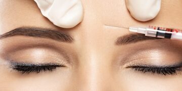 Alın Kırışıklıkları