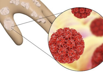 Hpv Enfeksiyon Riskinizi Düşürecek 8 Önlem