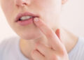 Ağız İçinde Oluşan Yaralar, Ciddi Hastalık Belirtisi Olabilir