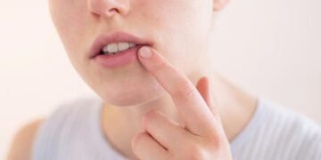 Ağız İçinde Oluşan Yaralar, Ciddi Hastalık Belirtisi Olabilir