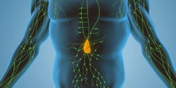 Bağışıklık Sisteminizin Gizli Düşmanı: Lenf Kanseri