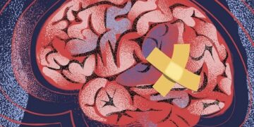 Beynin Kendini İyileştirme Yeteneği Öğrenme Güçlüğüne Umut Oluyor