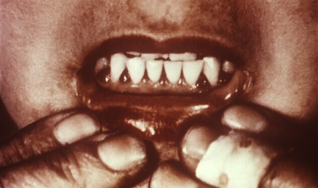 Geçmişin Denizci Hastalığı, Bugünün Sessiz Tehdidi: 'Skorbüt'