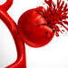 Aort Yırtılması Sessizce Geliyor!