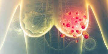 Meme Kanserinde Erken Tanı Hayat Kurtarıyor 