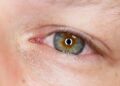 Dünyanız Kararmadan Önleminizi Alın: Retina Yırtığı