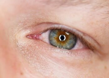Dünyanız Kararmadan Önleminizi Alın: Retina Yırtığı