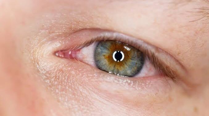 Dünyanız Kararmadan Önleminizi Alın: Retina Yırtığı